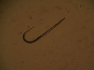 Larva de Strongyloides stercolaris en heces.