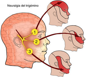 Distribución de las ramas del nervio trigémino.