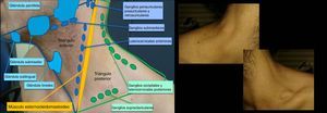 Esquema de anatomía cervical y fotografía del paciente.
