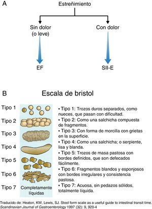 Tipos de estreñimiento. Fuente: Lewis y Heaton15.
