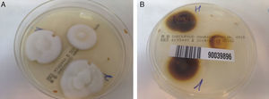 A) Anverso de la placa de Petri. Color blanquecino y textura algodonosa de Trichophyton rubrum. B) Reverso de la placa de Petri.