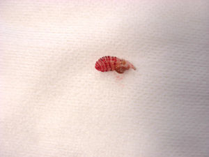 Larva de Dermatobia hominis tras la extracción.