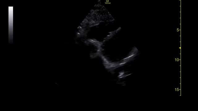 https://ars.els-cdn.com/content/image/1-s2.0-S1138359320301982-mmc1.mp4