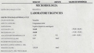 Resultado del análisis del LCR de la paciente del caso clínico. Nótese la disociación albuminocitológica característica del SGB.
