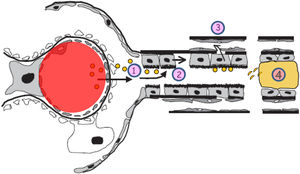 Cambios en el espacio túbulo-intersticial en el proceso de progresión de la enfermedad renal crónica. En la parte superior izquierda se muestran el túbulo y el intersticio normales. En la parte superior derecha se muestran los cambios relacionados con la progresión renal (inflamación, transformación de células tubulares, proliferación de matriz extracelular, activación de los fibroblastos, disminución de pericitos y densidad capilar y fibrosis). En la parte inferior se muestra el efecto de la toxicidad tubular de las proteínas filtradas por el glomérulo mediante los siguientes pasos: 1.Aparición de albuminuria/proteinuria. 2.Activación de las células tubulares para sintetizar mediadores inflamatorios. 3.El daño de la membrana basal tubular facilita el paso de mediadores inflamatorios hacia el intersticio y los capilares peritubulares. 4.En la nefrona distal los cilindros de proteínas pueden obstruir el flujo urinario, además de producir daño inflamatorio.