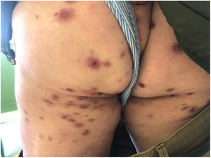 Clinical image of the patient