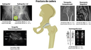 Sensibilidad y especificidad de cada tipo de prueba complementaria en el diagnóstico de la fractura de cadera. IA: inteligencia artificial. Elaboración propia. Fuente de las imágenes: 1. Di Muzio B, Comminuted intertrochanteric fracture. Case study, Radiopaedia.org https://doi.org/10.53347/rID-39409. 2. Booyabazooka. X-ray image of my own hip, with top of fémur broken [internet]. 2004. Disponible en: https://commons.m.wikimedia.org/wiki/File:Cdm_hip_fracture_343.jpg#mw-jump-to-license. 3. Schubert R, Impacted femoral neck fracture. Case study, Radiopaedia.org https://doi.org/10.53347/rID-24424. 4. Hartung M. Occult intertrochanteric fracture. Case study, Radiopaedia.org https://doi.org/10.53347/rID-63855. 5. Medero Colon R, Chilstrom ML. Diagnosis of an occult hip fracture by point-of-care ultrasound. J Emerg Med [Internet]. 2015;49(6):916–9. Disponible en: https://doi.org/10.1016/j.jemermed.2015.06.077. 6. Yang Z, Reed T, Simoncini AA. A clearly observable cold fracture line of an early occult hip fracture on bone scintigraphy. J Nucl Med Technol [Internet]. 2014;42(2):116–7. Disponible en: https://doi.org/10.2967/jnmt.113.130765.