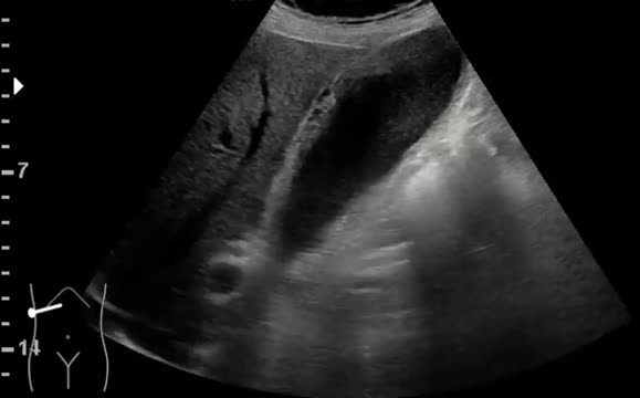 https://ars.els-cdn.com/content/image/1-s2.0-S1138359324001795-mmc3.mp4