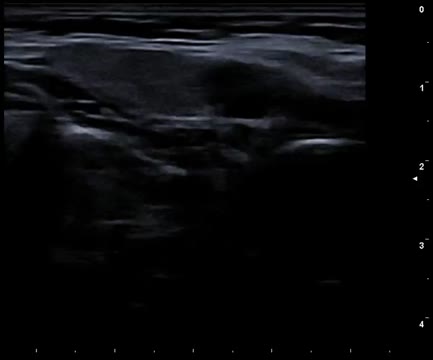 https://ars.els-cdn.com/content/image/1-s2.0-S1138359324001916-mmc1.mp4