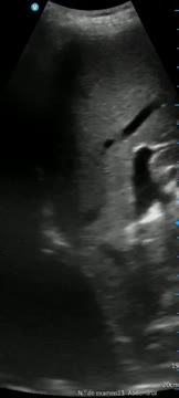 https://ars.els-cdn.com/content/image/1-s2.0-S113835932400193X-mmc1.mp4