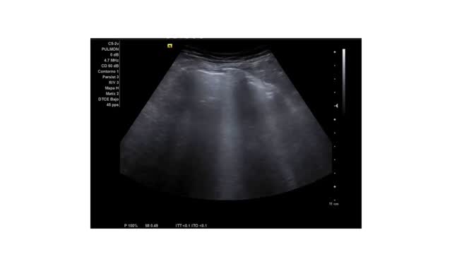 https://ars.els-cdn.com/content/image/1-s2.0-S113835932400193X-mmc2.mp4