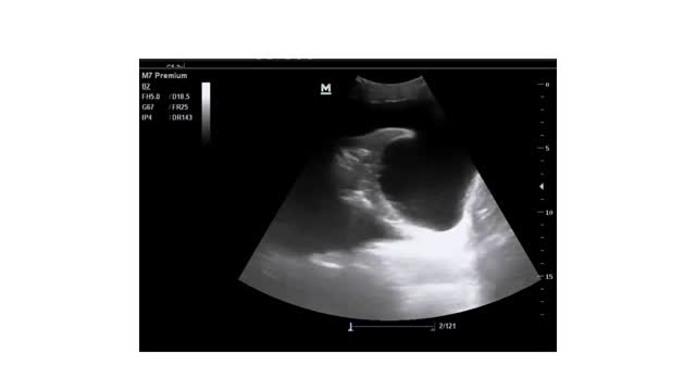 https://ars.els-cdn.com/content/image/1-s2.0-S113835932400193X-mmc3.mp4