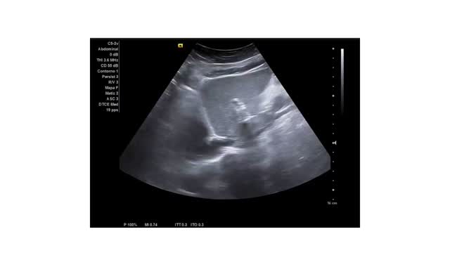 https://ars.els-cdn.com/content/image/1-s2.0-S113835932400193X-mmc4.mp4