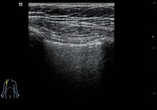 https://ars.els-cdn.com/content/image/1-s2.0-S1138359324001965-mmc4.mp4