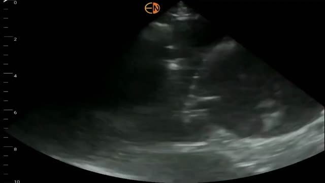 https://ars.els-cdn.com/content/image/1-s2.0-S1138359324001965-mmc5.mp4