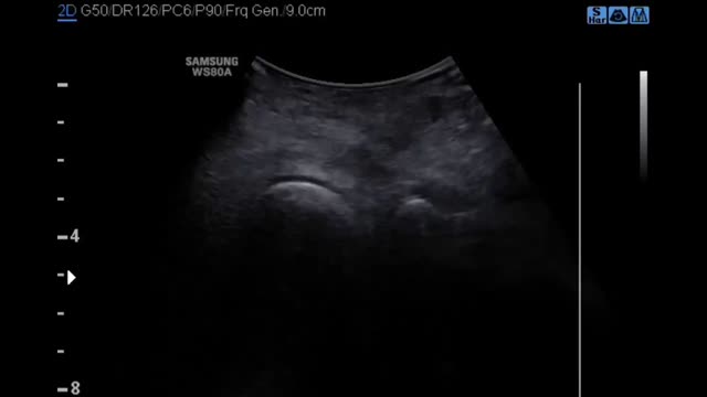 https://ars.els-cdn.com/content/image/1-s2.0-S1138359324002132-mmc2.mp4