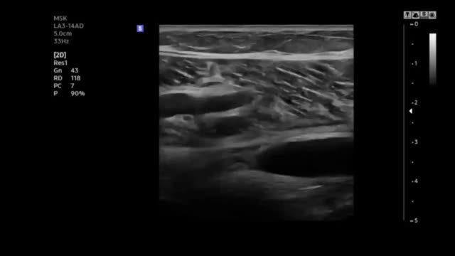 https://ars.els-cdn.com/content/image/1-s2.0-S1138359324002132-mmc3.mp4