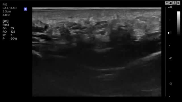 https://ars.els-cdn.com/content/image/1-s2.0-S1138359324002132-mmc5.mp4