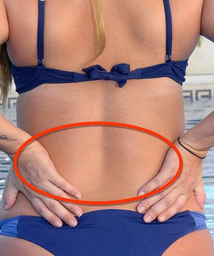 Localización del dolor lumbar.