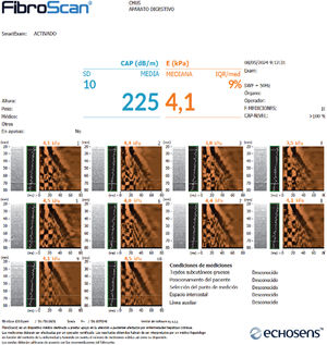 Informe de FibroScan realizado en Hepatología, con cuantificación de grado de esteatosis (CAP) y de rigidez hepática.