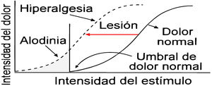 Representación esquemática de la alodinia y la hiperalgesia. El eje horizontal muestra la intensidad del estímulo aplicado, y el eje vertical la percepción del dolor. En la alodinia, estímulos normalmente no dolorosos generan dolor (desplazamiento hacia la izquierda del umbral). En la hiperalgesia, estímulos dolorosos provocan una respuesta exagerada (pendiente más pronunciada). Fuente: adaptada de Melvin et al.19.