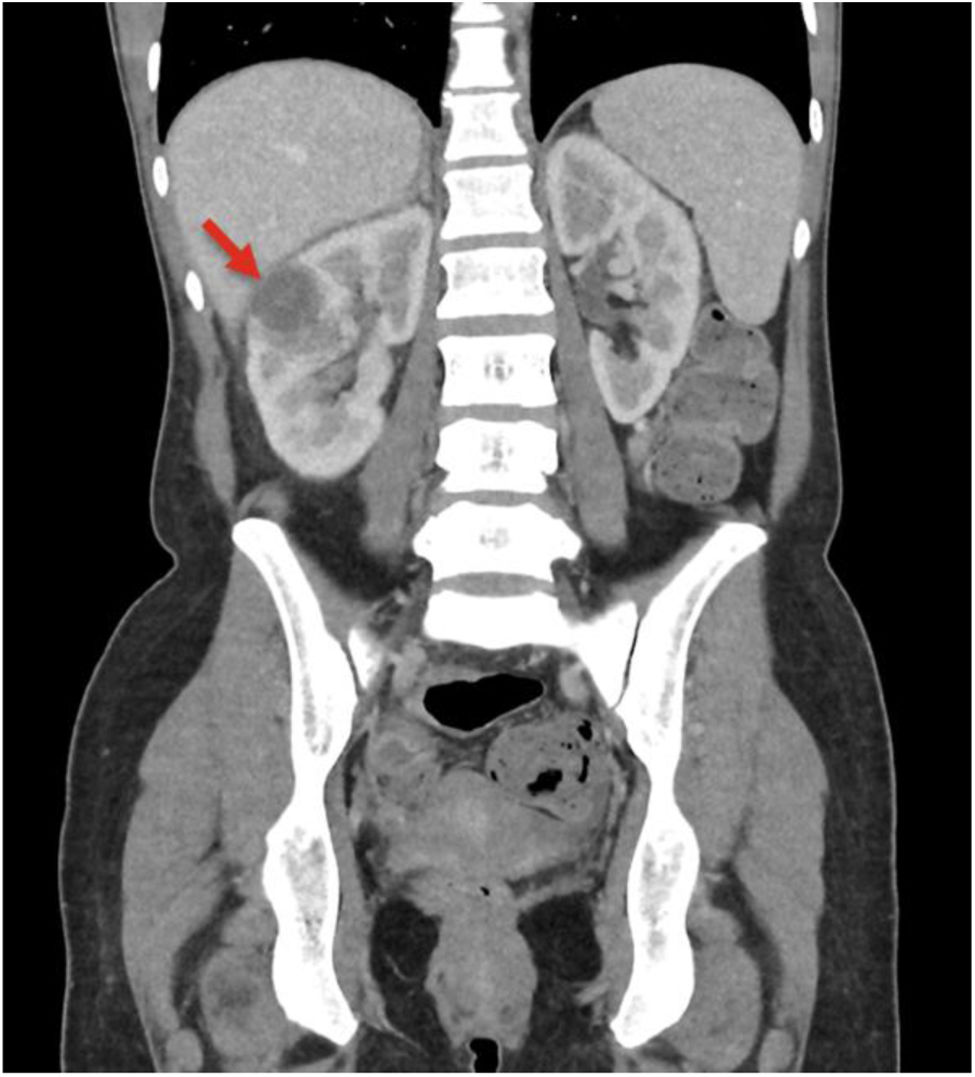 fig0010