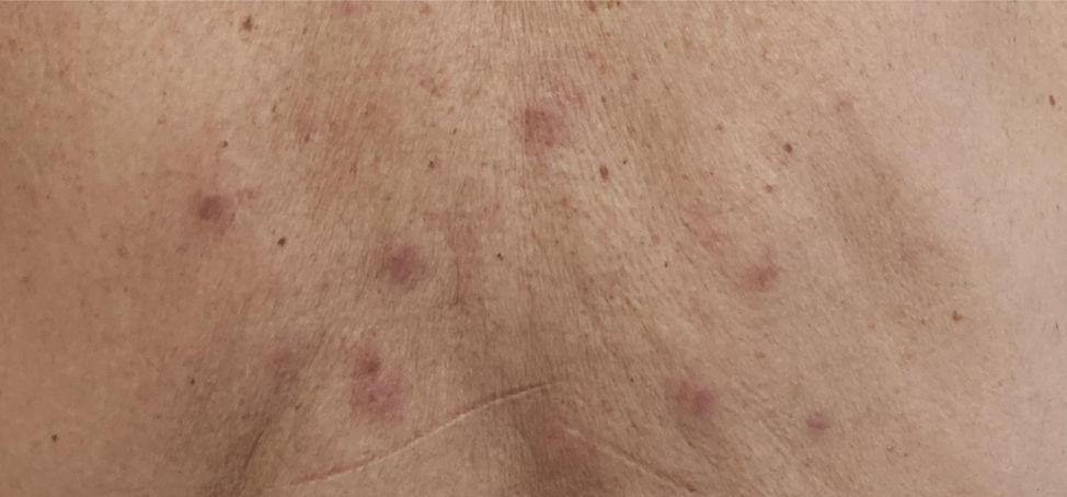 fig0010