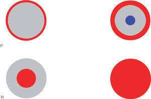 Evolución del agrietamiento en losa circular empotrada: a) parte superior y b) parte inferior
