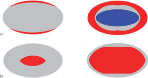 Evolución del agrietamiento en losa elíptica empotrada: a) parte superior y b) parte inferior