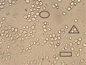 Muestra de bacterias en pulque, muestra saturada objetivo 40X, caracterización del género Zymomonas (ovalo), Saccharomyces (triangulo) y Leuconostoc (rectángulo).