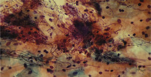 Hifas de C. albicans con tinción de papanicolaou modificado microfotografía con microscopio Zeiss, seco fuerte 40X e iluminación Köhler