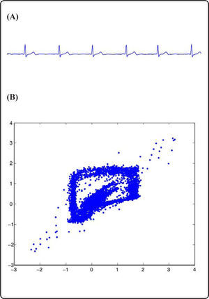 (A) Electrocardiograma típico de una persona sana. (B) Retrato de fase extraído de (A). Compare este retrato de fase con el de la Fig. 4C, en el que se muestra la curva cerrada.