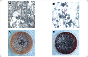 Fusarium verticillioides. Microconidias de F. verticillioides producidas en esporodoquios (A) y en cadenas (B). Cultivos de F. verticillioides en agar papa-dextrosa (C-D).
