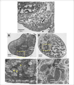 Desarrollo morfológico de las gónadas de conejo. A) Corte transversal de una cresta gonadal morfológicamente indiferenciada. B) Diferenciación morfológica del ovario, se observa la región medular y la corteza ovárica engrosada, en el recuadro amarillo se muestra la amplificación del corte mostrado en el panel C) las flechas señalan ovocitos que han iniciado la meiosis. D) Diferenciación morfológica del testículo fetal, en la región medular se observa la segregación de los cordones seminíferos, en el recuadro amarillo se muestra la amplificación de los cordones seminíferos junto con la rete testis (E).