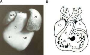 Corazón embrionario de pollo que muestra las cámaras cardíacas primitivas. A) Fotografía frontal. B) Esquema que muestra el interior el interior de la fotografía. T: tronco, AI: aurícula izquierdo; BC: bulbus cordis; C: cono; VP: ventrículo primitivo; AD: aurícula derecha.