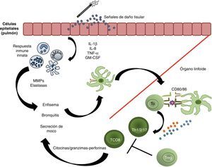 Respuesta immune en la patogénesis de la enfermedad pulmonar obstructiva crónica. Un estímulo externo provoca el daño de las células del epitelio pulmonar, por lo que estas liberan señales de daño que actúan como ligandos de algunos TLR, y se inicia la producción de citocinas y quimiocinas que estimulan la respuesta inmune innata. Durante su migración, las células dendríticas maduran; al llegar a los órganos linfoides llevan a cabo la presentación antigénica a los linfocitos T vírgenes para que estos se diferencien en células Th1, Th2, Th17 o T citotóxicas (T CD8+), y proliferen. Tras su activación, las células T efectoras liberan citocinas proinflamatorias, así como granzimas y perforinas. Los mecanismos de tolerancia periférica determinarán el grado de proliferación de las células efectoras, su localización y, eventualmente, la severidad de la enfermedad. En ese sentido, cuantas más fallas existan en la inmunorregulación inducida por las células Treg, más importante será la severidad de la enfermedad.