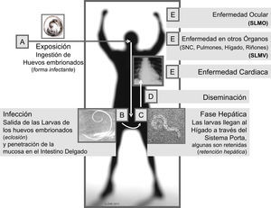 Ciclo de Toxocara spp. en el ser humano.