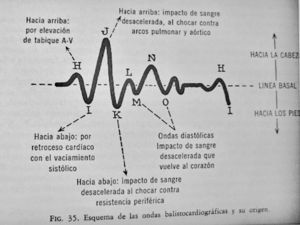 Curva de trazado balistocardiográfico. Tomado de Friedberg29 (pág. 90).