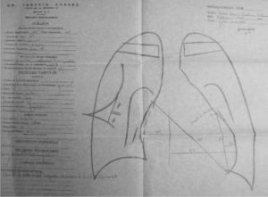 Ortodiagrama en papel parafina. Paciente con estenosis mitral: trazos realizados por el maestro Chávez. (Cortesía del doctor Ignacio Chávez Rivera).