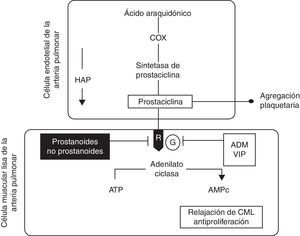 Esquema de la vía de la prostaciclina en la hipertensión arterial pulmonar. El ácido araquidónico es transformado por la Cox a un substrato de la prostaciclina sintetasa para formar prostaciclina en la célula endotelial. En la CML la prostaciclina liga a un receptor de membrana (R) que estimula a la adenilato ciclasa para producir AMPc y a través de esta, en la CML, promover relajación, además de tener efectos antiproliferadores. La prostaciclina inhibe la agregación plaquetaria. En la HAP los niveles de prostaciclina y de la sintetasa de prostaciclina están disminuidos. Fármacos prostanoides y no prostanoides pueden restaurar estos niveles parcialmente si actúan a nivel del receptor. Otras sustancias pueden activar a la adenilato ciclasa si ligan a la proteína G, como sucede con la ADM y el VIP. ADM: adrenomodulina; AMPc: adenosín-monofosfato-cíclico; ATP: trifosfato de adenosina; CML: célula de músculo liso; Cox: ciclooxigenasa; G: proteína G; HAP: hipertensión arterial pulmonar; R: receptor de prostaciclina; VIP: péptido intestinal vasoactivo. Figura modificada de Vachiéry24.