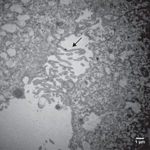 Eletromicrografias de CG cultivadas em meio TCM‐199 (144 h). Observar superfícies citoplasmáticas irregulares devido à presença de microvilosidades, evaginações e protusões pleomórficas sugestivas de luteinização (seta). ME: 10.000X.