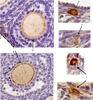 Corte de ovário. A marcação citoplasmática de DDX4/MVH (cor castanha) foi positiva somente para oócitos em: a, oócito em folículo primordial; b, oócito em folículo em transição primordial‐primário; c, oócito em folículo primário; d, oócito em folículo pré‐antral; e, oócito em folículo antral; f, foram marcadas células germinativas alheias à estrutura folicular (aumento de 40×).