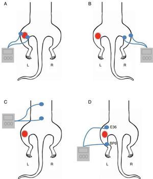 Placement of electrodes. (A) Dermatome. (B) Extrasegmental. (C) Paraspinal Muscles. (D) Acupoints (E36 and Bp6). L and R mean left and right paw, respectively.