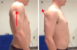 Pectoralis minor muscle active lengthening technique. (A) Maximal scapular elevation; (B) maximal scapular adduction.