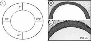 (A) Schematic representation of a cross-section of the aorta showing the locations where measurements of the wall thickness were taken. (B and C) Photomicrographs of aortic wall sections from the CG (B) and TG (C) rats stained with hematoxylin and eosin and taken with the same magnification. The wall thickness in (C) seems to be greater than in (B).