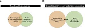 (A) Functional brain overlap of the SMA/Pre-SMA and MCC. This simplistic figure potentially explains why a large percentage of patients who present with pain in the physical therapy clinic also have underlying motor control impairments. The larger the overlap, the potentially more complicated a patient may be. (B) Disambiguating pain and motor processing. This figure illustrates less overlap between motor and pain/cognitive and affective processing, which may theoretically result in a less complicated patient presentation, or interaction between the two variables.