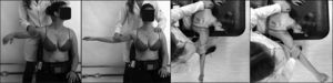 Test positions during maximal and submaximal muscle contractions for the upper-clavicular fibers (a), upper-acromial fibers (b), middle (c), and lower (d) trapezius. Manual resistance was applied for maximal voluntary contractions, as shown in the pictures. The same positions were used for submaximal voluntary contractions with subjects holding a halter of 1kg.