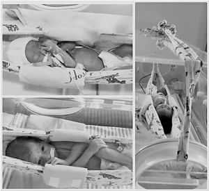 Hammock positioning of newborns within incubators.