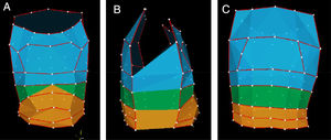 Three-dimensional model of the chest wall obtained by optoelectronic plethysmography during a data collection. (A) Anterior view; (B) lateral view; (C) posterior view. In blue: pulmonary rib cage; in green: abdominal rib cage; in orange: abdomen.