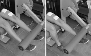 Exercise execution during training sessions – bilateral concentric movement phase for ∼1s (A) and unilateral eccentric phase for ∼4s (B). Images also show the positioning of electrodes used in the ECC+NMES group.